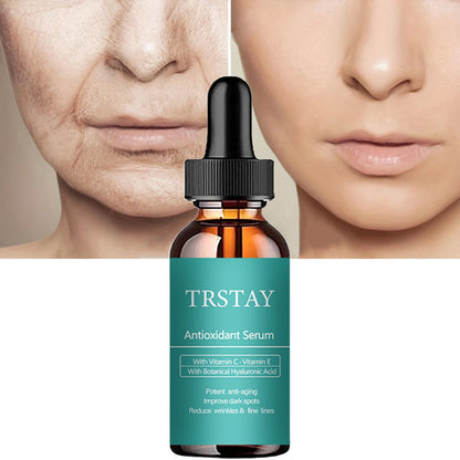 TRSTAY Antioxidant serum Using Vitamin C · Vitamin E Using plant hyaluronic acid Strong anti-aging and improving black skin Spo