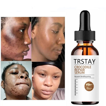 Hyaluronic Acid Plant Essence Moisturizing Vitamin C Stock Solution Face Serum Anti Wrinkle Hydrating Brightening Facial Essence